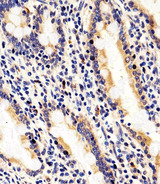 RAB35 Antibody - Immunohistochemical of paraffin-embedded H.small intestine section using RAB35 Antibody. Antibody was diluted at 1:25 dilution. A peroxidase-conjugated goat anti-rabbit IgG at 1:400 dilution was used as the secondary antibody, followed by DAB staining.