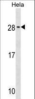 RAB35 Antibody - RAB35 Antibody western blot of HeLa cell line lysates (35 ug/lane). The RAB35 antibody detected the RAB35 protein (arrow).