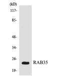 RAB35 Antibody - Western blot analysis of the lysates from HT-29 cells using RAB35 antibody.