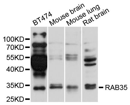 RAB35 Antibody - Western blot analysis of extracts of various cells.