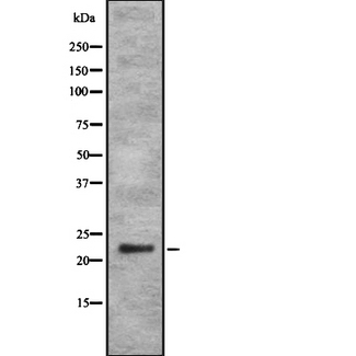 RAB35 Antibody - Western blot analysis of RAB35 using K562 whole cells lysates