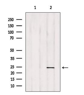 RAB35 Antibody - Western blot analysis of extracts of HepG2 cells using RAB35 antibody. Lane 1 was treated with the blocking peptide.
