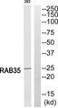 RAB35 Antibody - Western blot analysis of extracts from 293 cells, using RAB35 antibody.