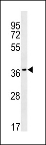 RAB36 Antibody - RAB36 Antibody western blot of NCI-H460 cell line lysates (35 ug/lane). The RAB36 Antibody detected the RAB36 protein (arrow).