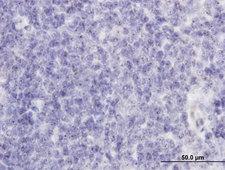 RAB36 Antibody - Immunoperoxidase of monoclonal antibody to RAB36 on formalin-fixed paraffin-embedded human tonsil. [antibody concentration 1.5 ug/ml]