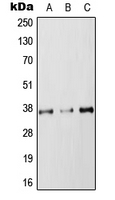 RAB36 Antibody - Western blot analysis of RAB36 expression in HEK293T (A); NIH3T3 (B); PC12 (C) whole cell lysates.