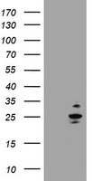 RAB37 Antibody - HEK293T cells were transfected with the pCMV6-ENTRY control (Left lane) or pCMV6-ENTRY RAB37 (Right lane) cDNA for 48 hrs and lysed. Equivalent amounts of cell lysates (5 ug per lane) were separated by SDS-PAGE and immunoblotted with anti-RAB37.