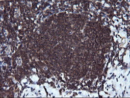RAB37 Antibody - IHC of paraffin-embedded Human tonsil using anti-RAB37 mouse monoclonal antibody.