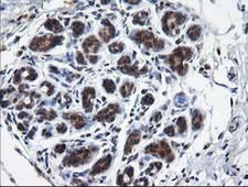 RAB37 Antibody - IHC of paraffin-embedded Human breast tissue using anti-RAB37 mouse monoclonal antibody.