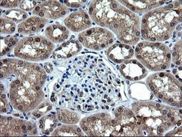 RAB37 Antibody - IHC of paraffin-embedded Human Kidney tissue using anti-RAB37 mouse monoclonal antibody.