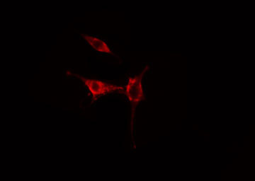 RAB37 Antibody - Staining HuvEc cells by IF/ICC. The samples were fixed with PFA and permeabilized in 0.1% Triton X-100, then blocked in 10% serum for 45 min at 25°C. The primary antibody was diluted at 1:200 and incubated with the sample for 1 hour at 37°C. An Alexa Fluor 594 conjugated goat anti-rabbit IgG (H+L) antibody, diluted at 1/600, was used as secondary antibody.