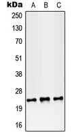 RAB38 Antibody - Western blot analysis of RAB38 expression in MCF7 (A); SP2/0 (B); PC12 (C) whole cell lysates.