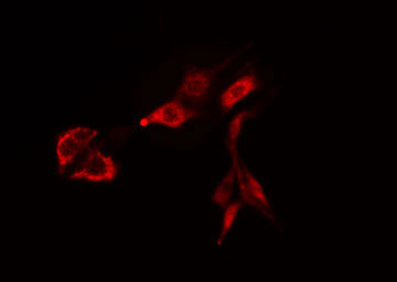 RAB38 Antibody - Staining HeLa cells by IF/ICC. The samples were fixed with PFA and permeabilized in 0.1% Triton X-100, then blocked in 10% serum for 45 min at 25°C. The primary antibody was diluted at 1:200 and incubated with the sample for 1 hour at 37°C. An Alexa Fluor 594 conjugated goat anti-rabbit IgG (H+L) antibody, diluted at 1/600, was used as secondary antibody.