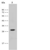 RAB38 Antibody - Anti-RAB38 rabbit polyclonal antibody at 1:500 dilution. Lane A: A-431 Whole Cell Lysate. Lysates/proteins at 30 ug per lane. Secondary: Goat Anti-Rabbit IgG (H+L)/HRP at 1/10000 dilution. Developed using the ECL technique. Performed under reducing conditions. Predicted band size: 24 kDa. Observed band size: 28 kDa.