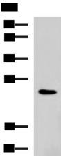 RAB38 Antibody - Western blot analysis of NIH/3T3 cell lysate  using RAB38 Polyclonal Antibody at dilution of 1:900