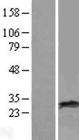 RAB38 Protein - Western validation with an anti-DDK antibody * L: Control HEK293 lysate R: Over-expression lysate