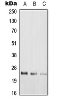 RAB39 / RAB39A Antibody - Western blot analysis of RAB39A expression in HeLa (A); rat lung (B); H9C2 (C) whole cell lysates.