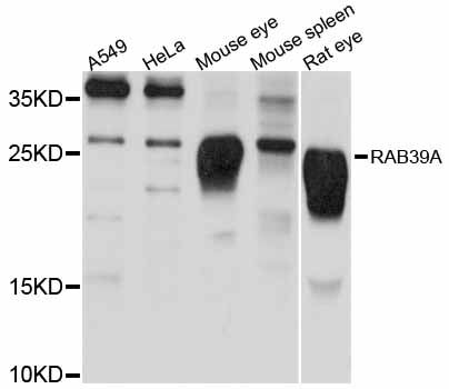 RAB39 / RAB39A Antibody - Western blot analysis of extracts of various cell lines, using RAB39A antibody at 1:1000 dilution. The secondary antibody used was an HRP Goat Anti-Rabbit IgG (H+L) at 1:10000 dilution. Lysates were loaded 25ug per lane and 3% nonfat dry milk in TBST was used for blocking. An ECL Kit was used for detection and the exposure time was 10s.