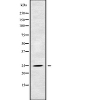 RAB39 / RAB39A Antibody - Western blot analysis of RAB39A using HeLa whole cells lysates