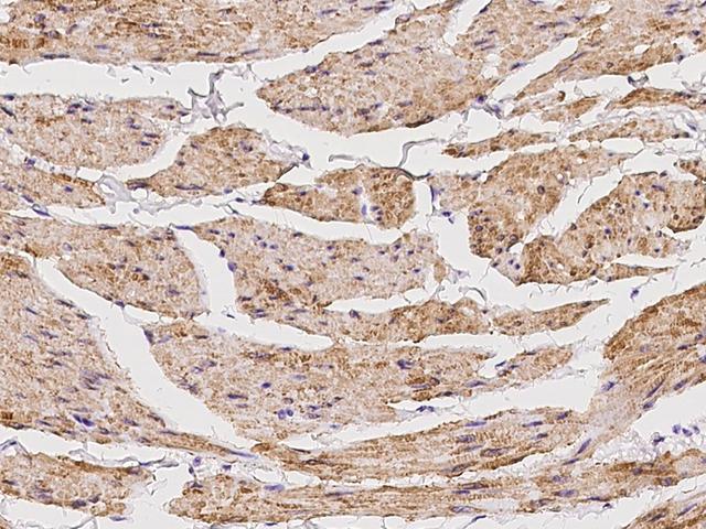 RAB39 / RAB39A Antibody - Immunochemical staining of human RAB39A in human smooth muscle with rabbit polyclonal antibody at 1:1000 dilution, formalin-fixed paraffin embedded sections.