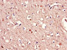 RAB39B Antibody - Immunohistochemistry of paraffin-embedded human brain tissue using RAB39B Antibody at dilution of 1:100