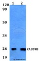 RAB39B Antibody - Western blot of RAB39B antibody at 1:500 dilution. Lane 1: MCF-7 whole cell lysate. Lane 2: H9C2 whole cell lysate.