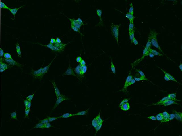 RAB39B Antibody - Immunofluorescence staining of RAB39B in SHSY5Y cells. Cells were fixed with 4% PFA, permeabilzed with 0.1% Triton X-100 in PBS, blocked with 10% serum, and incubated with rabbit anti-Human RAB39B polyclonal antibody (dilution ratio 1:200) at 4°C overnight. Then cells were stained with the Alexa Fluor 488-conjugated Goat Anti-rabbit IgG secondary antibody (green) and counterstained with DAPI (blue). Positive staining was localized to Cytoplasm.