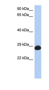 RAB39B Antibody - RAB39B antibody Western blot of Fetal Stomach lysate. This image was taken for the unconjugated form of this product. Other forms have not been tested.