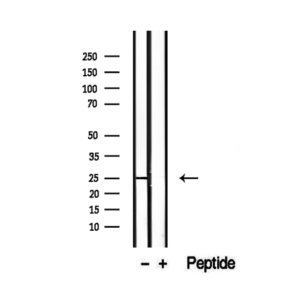 RAB3A Antibody - Western blot analysis of extracts of mouse brain tissue using RAB3A antibody.