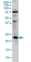 RAB3A Antibody - RAB3A monoclonal antibody (M01), clone 4H7 Western Blot analysis of RAB3A expression in IMR-32.