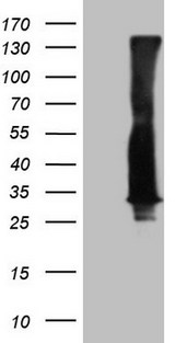 RAB3A Antibody - HEK293T cells were transfected with the pCMV6-ENTRY control. (Left lane) or pCMV6-ENTRY RAB3A. (Right lane) cDNA for 48 hrs and lysed. Equivalent amounts of cell lysates. (5 ug per lane) were separated by SDS-PAGE and immunoblotted with anti-RAB3A. (1:2000)
