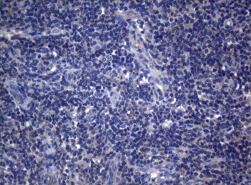 RAB3A Antibody - Immunohistochemical staining of paraffin-embedded Human lymph node tissue within the normal limits using anti-RAB3A mouse monoclonal antibody. (Heat-induced epitope retrieval by 1mM EDTA in 10mM Tris buffer. (pH8.5) at 120°C for 3 min. (1:150)