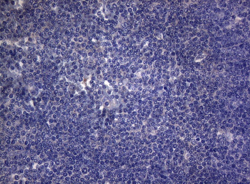 RAB3A Antibody - Immunohistochemical staining of paraffin-embedded Human lymphoma tissue using anti-RAB3A mouse monoclonal antibody. (Heat-induced epitope retrieval by 1mM EDTA in 10mM Tris buffer. (pH8.5) at 120°C for 3 min. (1:150)