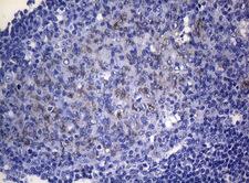 RAB3A Antibody - Immunohistochemical staining of paraffin-embedded Human tonsil within the normal limits using anti-RAB3A mouse monoclonal antibody. (Heat-induced epitope retrieval by 1mM EDTA in 10mM Tris buffer. (pH8.5) at 120°C for 3 min. (1:150)