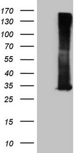 RAB3A Antibody - HEK293T cells were transfected with the pCMV6-ENTRY control. (Left lane) or pCMV6-ENTRY RAB3A. (Right lane) cDNA for 48 hrs and lysed. Equivalent amounts of cell lysates. (5 ug per lane) were separated by SDS-PAGE and immunoblotted with anti-RAB3A. (1:2000)