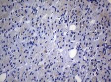 RAB3A Antibody - Immunohistochemical staining of paraffin-embedded Carcinoma of Human pancreas tissue using anti-RAB3A mouse monoclonal antibody. (Heat-induced epitope retrieval by 1mM EDTA in 10mM Tris buffer. (pH8.5) at 120°C for 3 min. (1:150)