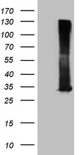 RAB3A Antibody - HEK293T cells were transfected with the pCMV6-ENTRY control. (Left lane) or pCMV6-ENTRY RAB3A. (Right lane) cDNA for 48 hrs and lysed