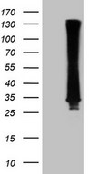 RAB3A Antibody - HEK293T cells were transfected with the pCMV6-ENTRY control. (Left lane) or pCMV6-ENTRY RAB3A. (Right lane) cDNA for 48 hrs and lysed. Equivalent amounts of cell lysates. (5 ug per lane) were separated by SDS-PAGE and immunoblotted with anti-RAB3A. (1:2000)