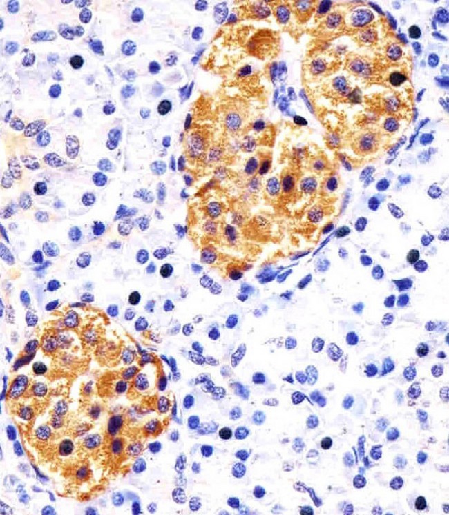 RAB3B Antibody - Antibody staining RAB3B in human pancreas sections by Immunohistochemistry (IHC-P - paraformaldehyde-fixed, paraffin-embedded sections). Tissue was fixed with formaldehyde and blocked with 3% BSA for 0. 5 hour at room temperature; antigen retrieval was by heat mediation with a citrate buffer (pH 6). Samples were incubated with primary antibody (1:25) for 1 hours at 37°C. A undiluted biotinylated goat polyvalent antibody was used as the secondary antibody.