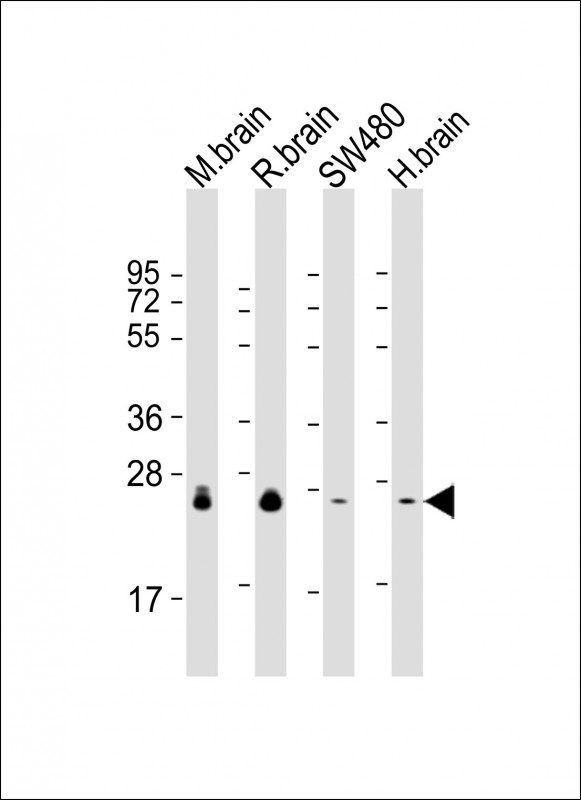 RAB3B Antibody - All lanes: Anti-RAB3B Antibody at 1:2000 dilution. Lane 1: mouse brain lysate. Lane 2: rat brain lysate. Lane 3: SW480 whole cell lysate. Lane 4: human brain lysate Lysates/proteins at 20 ug per lane. Secondary Goat Anti-mouse IgG, (H+L), Peroxidase conjugated at 1:10000 dilution. Predicted band size: 25 kDa. Blocking/Dilution buffer: 5% NFDM/TBST.