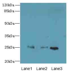RAB3B Antibody - Western blot. All lanes: RAB3B antibody at 4 ug/ml. Lane 1: Mouse brain tissue. Lane 2: U251 whole cell lysate. Lane 3: U87 whole cell lysate. Secondary Goat polyclonal to Rabbit IgG at 1:10000 dilution. Predicted band size: 25 kDa. Observed band size: 25 kDa.