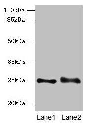 RAB3B Antibody - Western blot All lanes: RAB3B antibody at 4µg/ml Lane 1: Mouse brain tissue Lane 2: U251 whole cell lysate Lane 3: U87 whole cell lysate Secondary Goat polyclonal to rabbit IgG at 1/10000 dilution Predicted band size: 25 kDa Observed band size: 25 kDa
