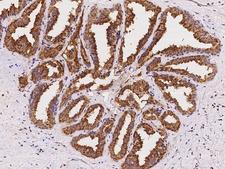 RAB3B Antibody - Immunochemical staining of human RAB3B in human prostate with rabbit polyclonal antibody at 1:100 dilution, formalin-fixed paraffin embedded sections.