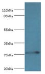 RAB3C Antibody - Western blot. All lanes: Ras-related protein Rab-3C antibody at 2 ug/ml+mouse brain tissue. Secondary antibody: Goat polyclonal to rabbit at 1:10000 dilution. Predicted band size: 26 kDa. Observed band size: 26 kDa.  This image was taken for the unconjugated form of this product. Other forms have not been tested.