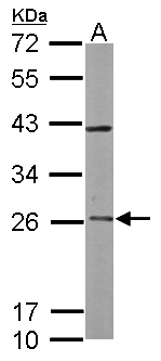 RAB3C Antibody - Sample (50 ug of whole cell lysate). A: mouse brain. 12% SDS PAGE. RAB3C antibody diluted at 1:5000.
