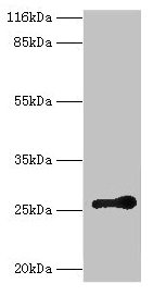 RAB3C Antibody - Western blot All lanes: RAB3C antibody at 2µg/ml + Mouse brain tissue Secondary Goat polyclonal to rabbit IgG at 1/10000 dilution Predicted band size: 26 kDa Observed band size: 26 kDa