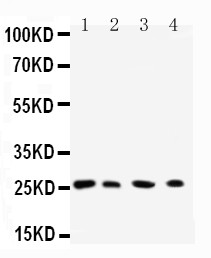 RAB3C Antibody - WB of RAB3C antibody. All lanes: Anti-RAB3C at 0.5ug/ml. Lane 1: Rat Brain Tissue Lysate at 40ug. Lane 2: HELA Whole Cell Lysate at 40ug. Lane 3: 293T Whole Cell Lysate at 40ug. Lane 4: COLO320 Whole Cell Lysate at 40ug. Predicted bind size: 26KD. Observed bind size: 26KD.