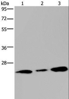 RAB3C Antibody - Western blot analysis of Human fetal brain tissue and 293T cell, using RAB3c Polyclonal Antibody at dilution of 1:400.