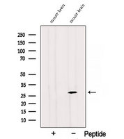 RAB3C Antibody - Western blot analysis of extracts of mouse brain tissue using RAB3C antibody. The lane on the left was treated with blocking peptide.