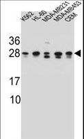 RAB3D Antibody - RAB3D Antibody western blot of K562,HL-60,MDA-MB231,MDA-MB453,CEM cell line lysates (35 ug/lane). The RAB3D antibody detected the RAB3D protein (arrow).